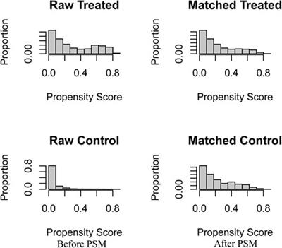 Survival benefit of surgical resection for stage IV gastric cancer: A SEER-based propensity score-matched analysis
